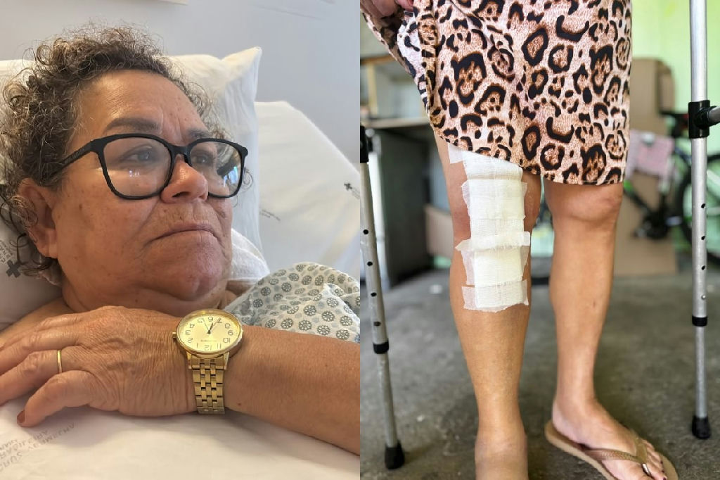 Cirurgia de joelho errado: filha de idosa no PR denuncia médico por culpar paciente