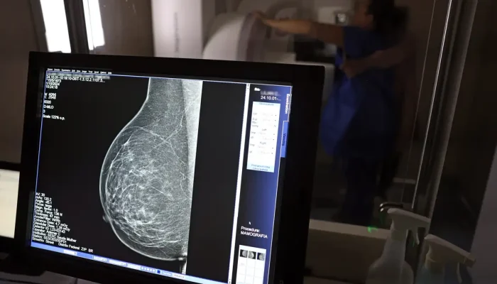 Entidades médicas emitem alerta sobre pedidos de mamografia digital